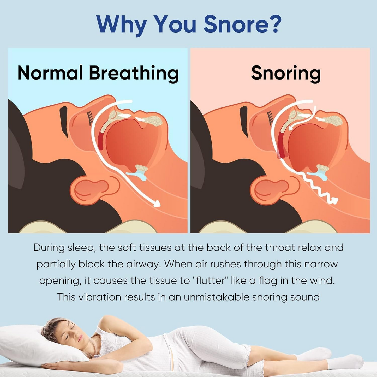 Anti-Snoring Mouthpiece